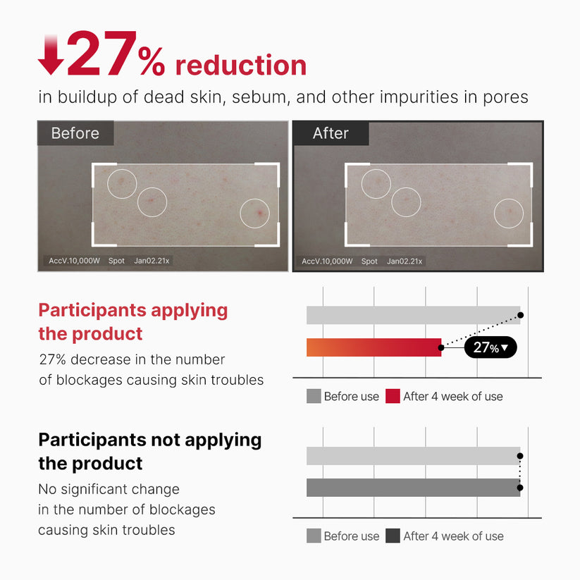 Medicube Red Acne Body Peeling Shot 110g