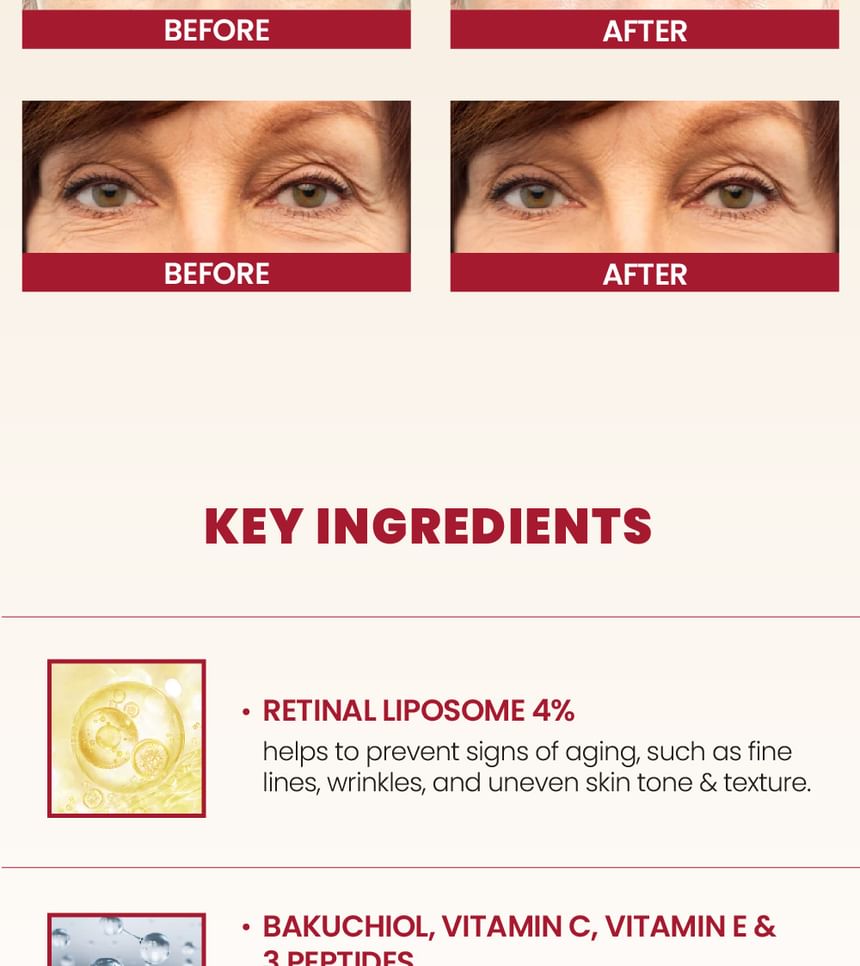 KSECRET SEOUL 1988 Eye Cream Retinal Liposome 4% + Fermented Bean 30Ml